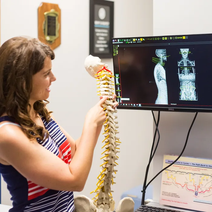 Dr. Noonan explaining spinal curvature with a spine model and X-rays